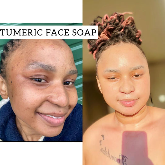 TUMERIC FACE SOAP